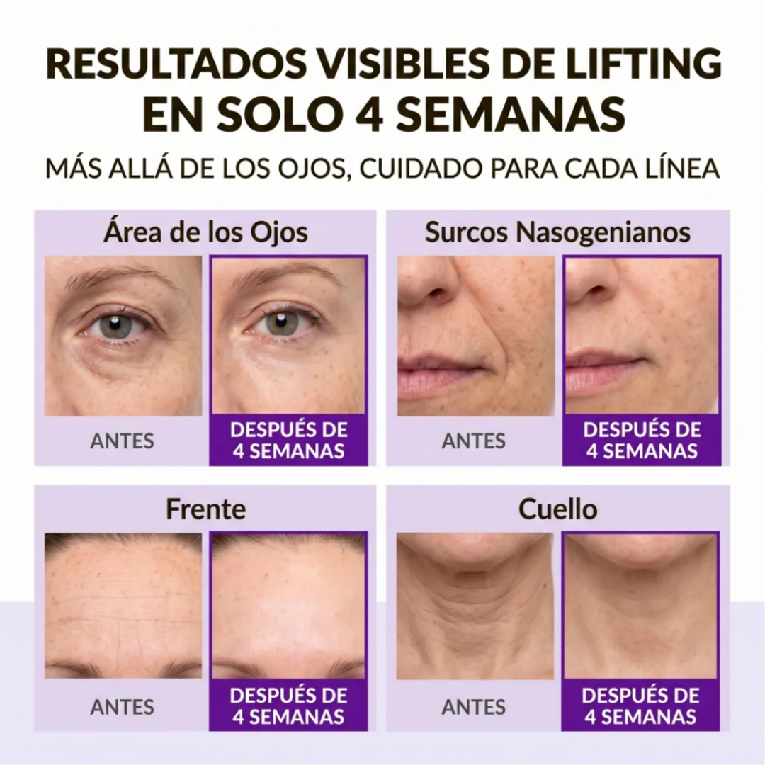 Crema Reafirmante 360º Shot PDRN Lifting Eye Cream 30ml - Centellian24