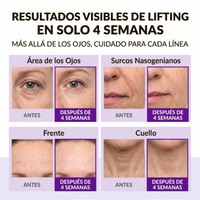 Crema Reafirmante 360º Shot PDRN Lifting Eye Cream 30ml - Centellian24