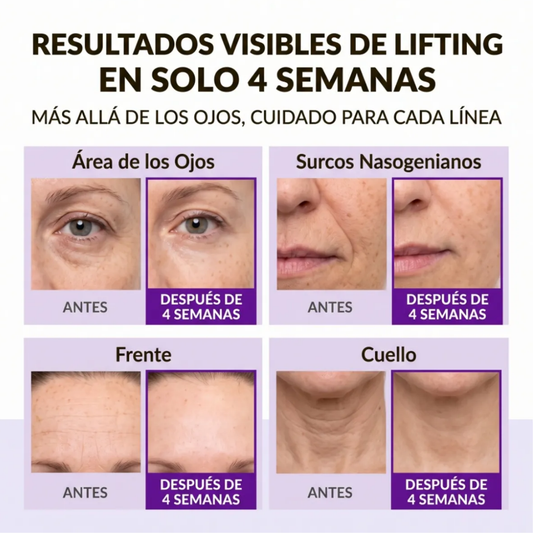 Crema Reafirmante 360º Shot PDRN Lifting Eye Cream 30ml - Centellian24
